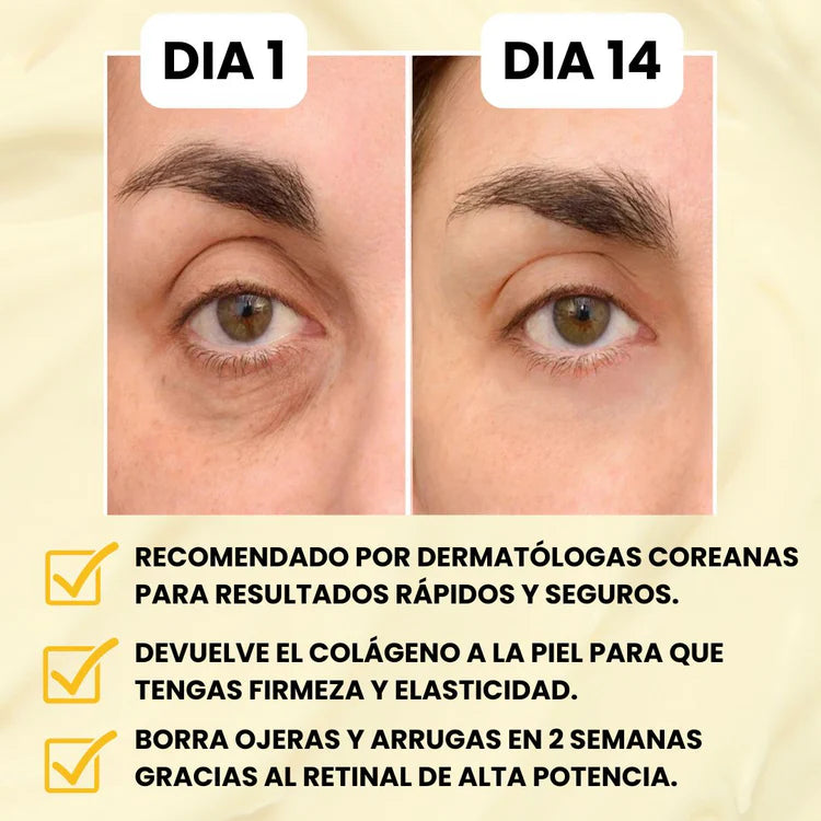 Crema Nida®: Despídete de esas ojeras que te envejecen en tan solo dias